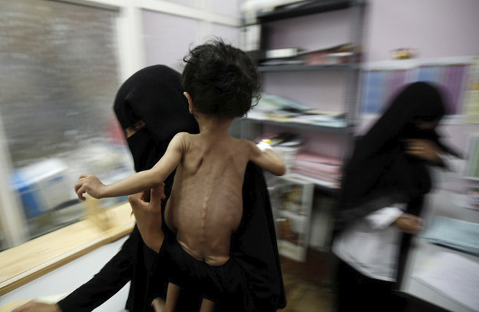 Yemen’deki durumu BM yetkilisi hatırlattı: Kıtlığın eşliğinde
