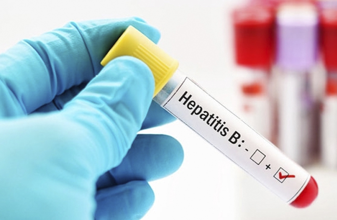 Türkiye’de 3,5 milyon kişi hepatit B hastası